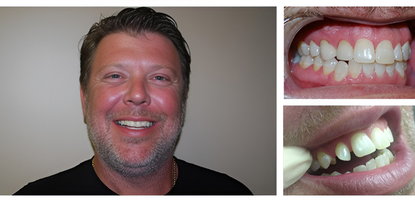 Bright Smiles Dental Image