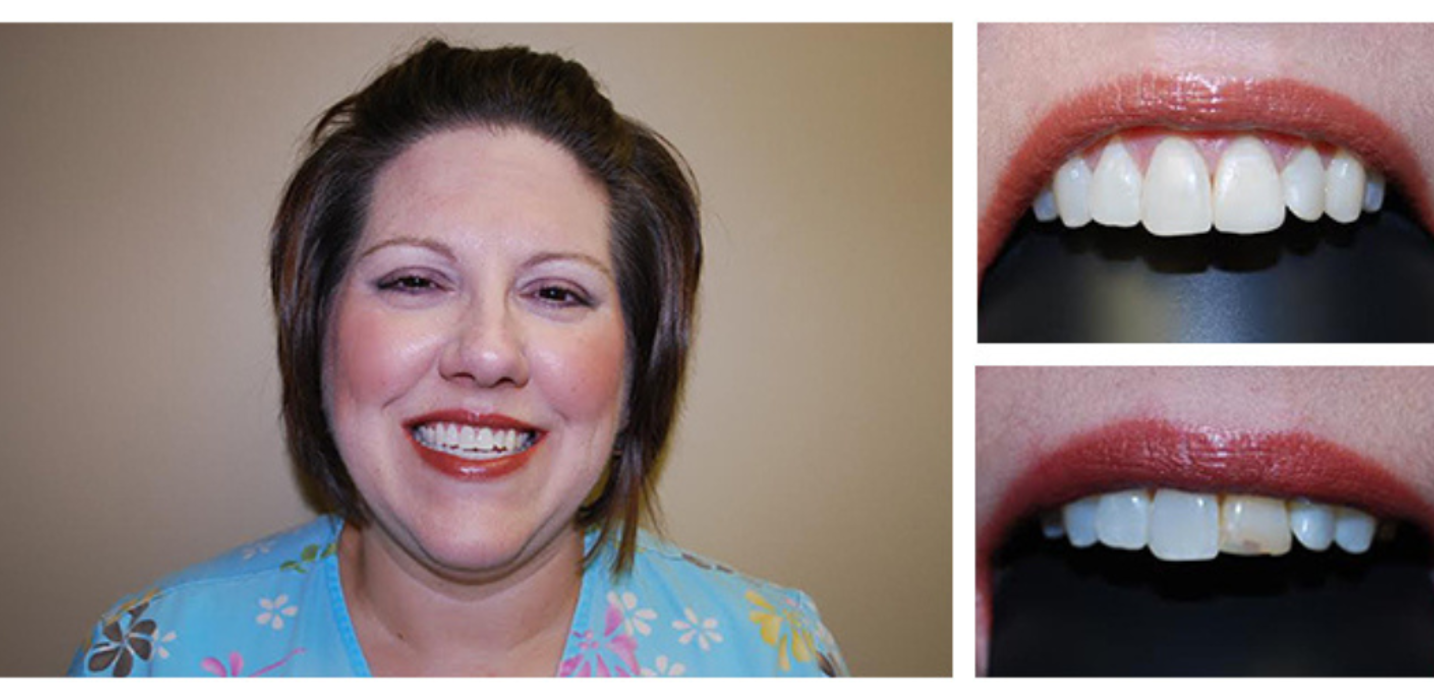 Bright Smiles Dental Image