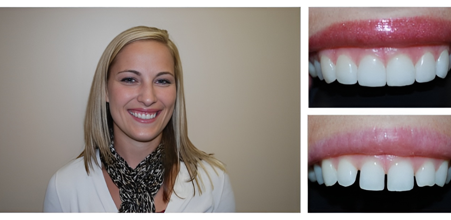 Bright Smiles Dental Image