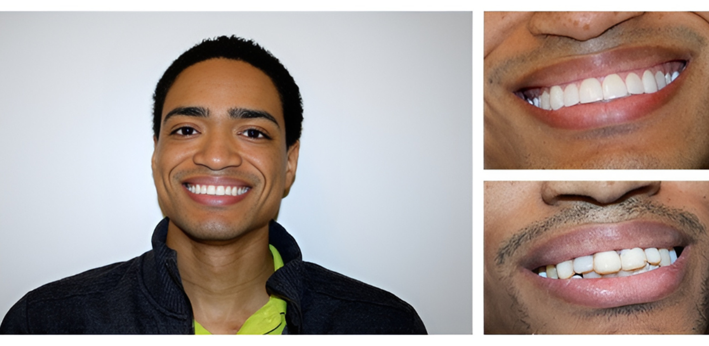 Bright Smiles Dental Image