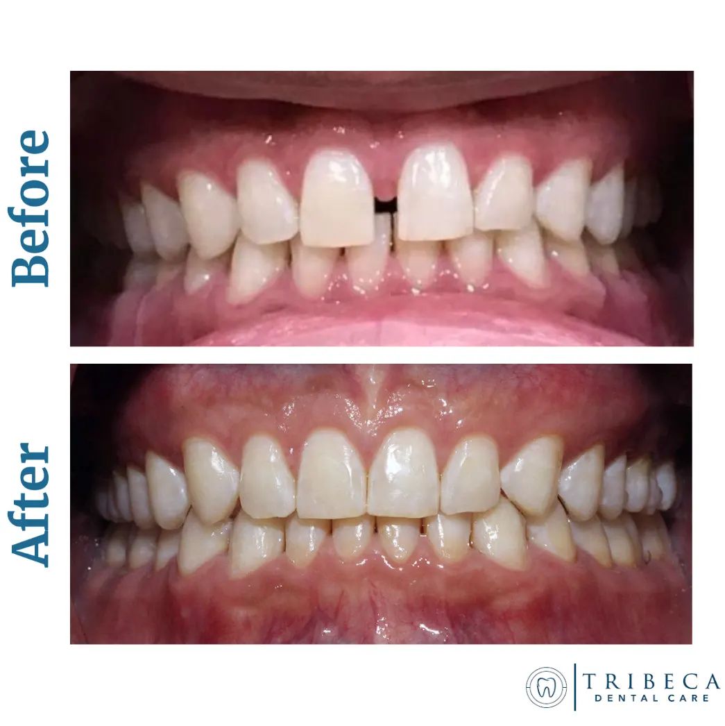 Image 7 | Tribeca Dental Care