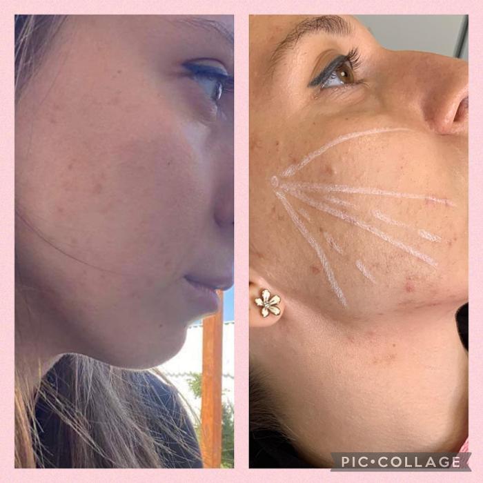 Diamond FACES GmbH, Wiener Straße in Ebreichsdorf