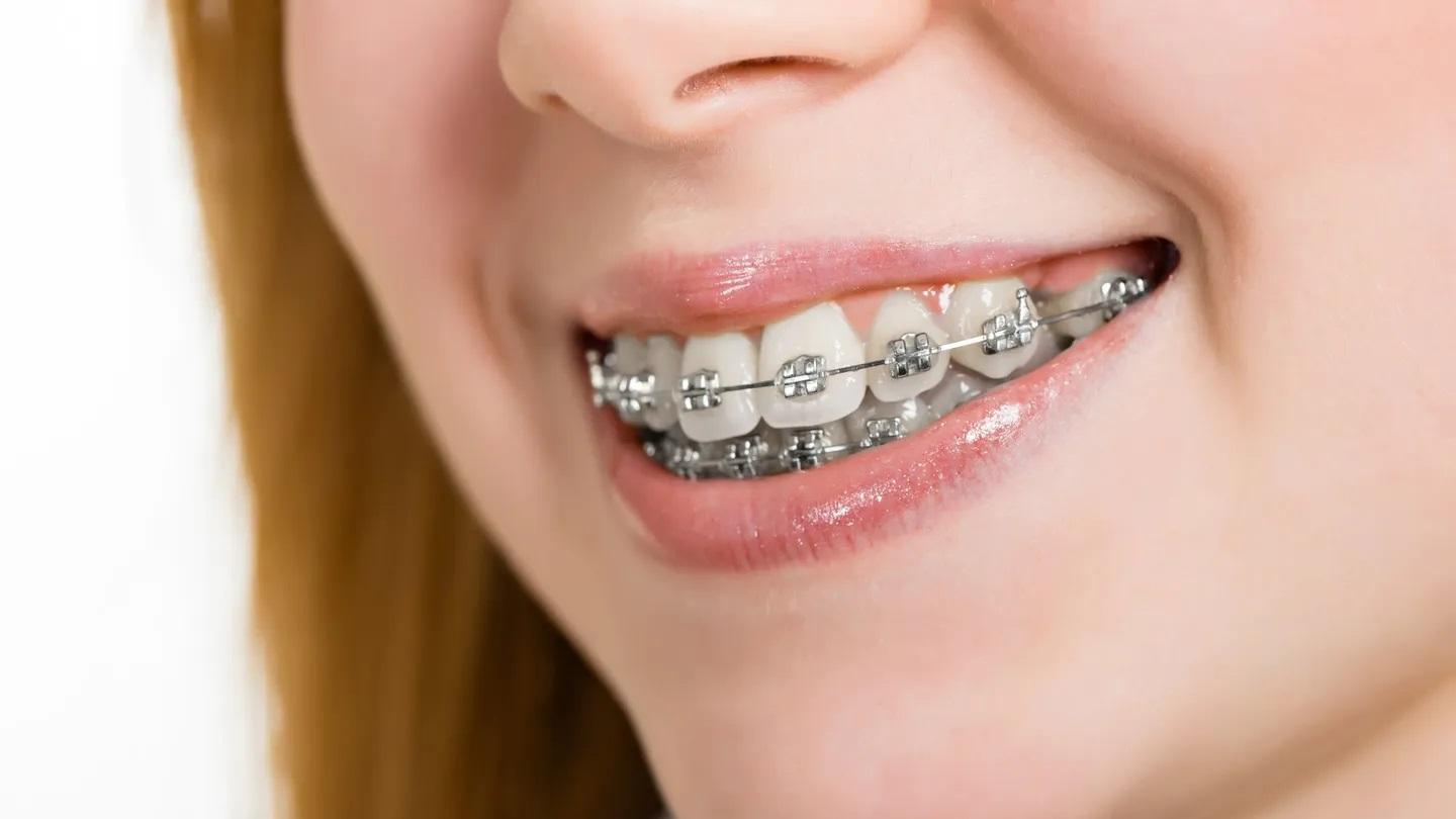 Kieferorthopäde Stummer Hanau - Für Kinder und Erwachsene, Philippsruher Allee in Hanau