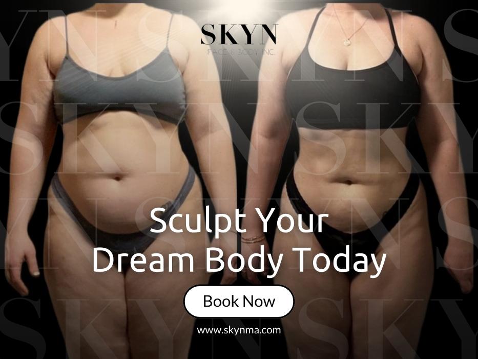 SKYN Face & Body Inc. - Northborough, MA