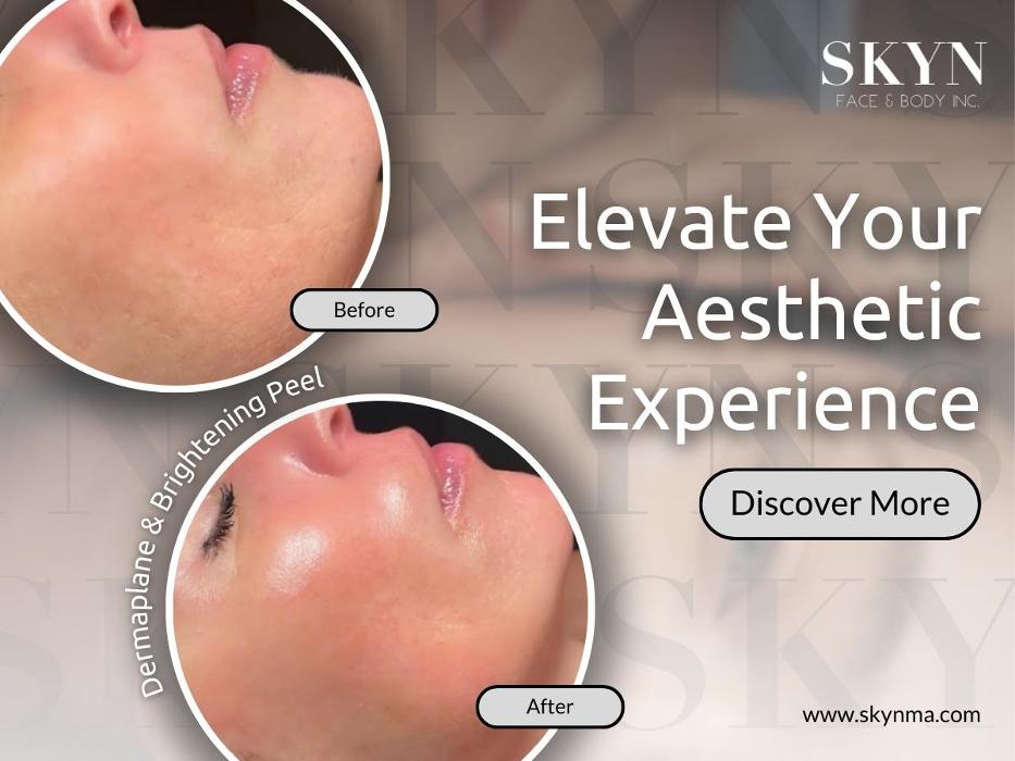 SKYN Face & Body Inc. - Northborough, MA