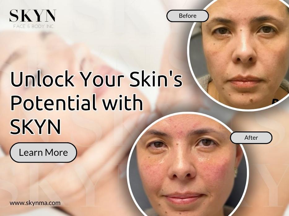 SKYN Face & Body Inc. - Northborough, MA