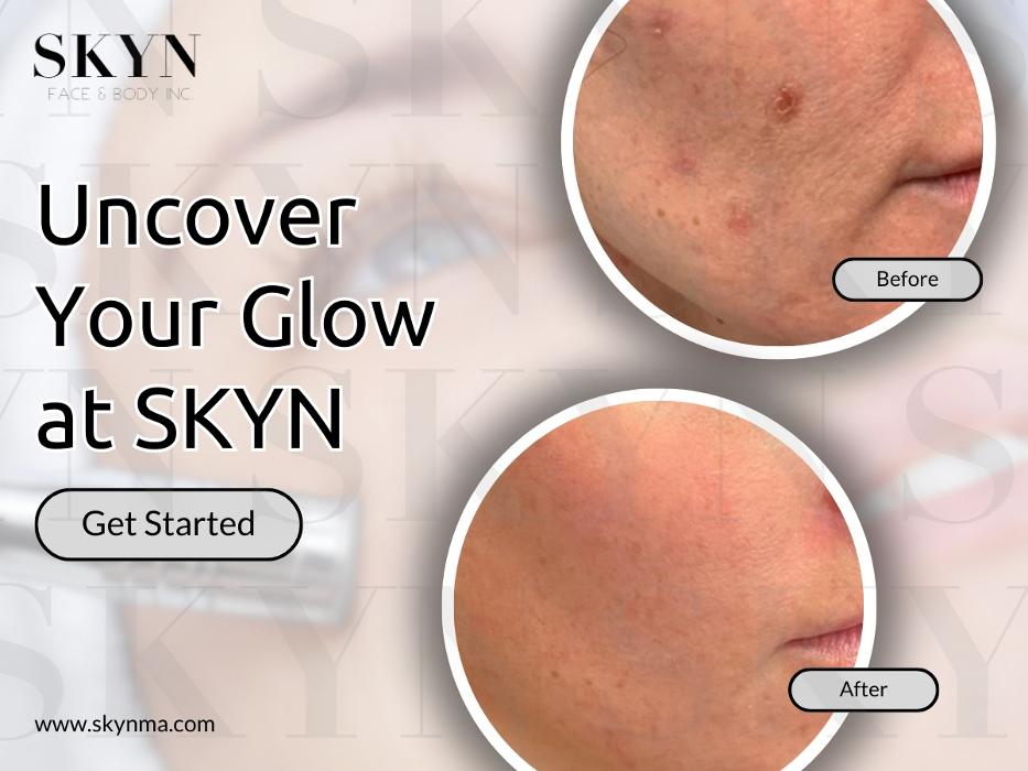 SKYN Face & Body Inc. - Northborough, MA