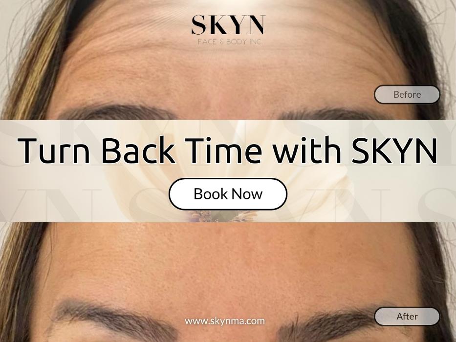 SKYN Face & Body Inc. - Northborough, MA