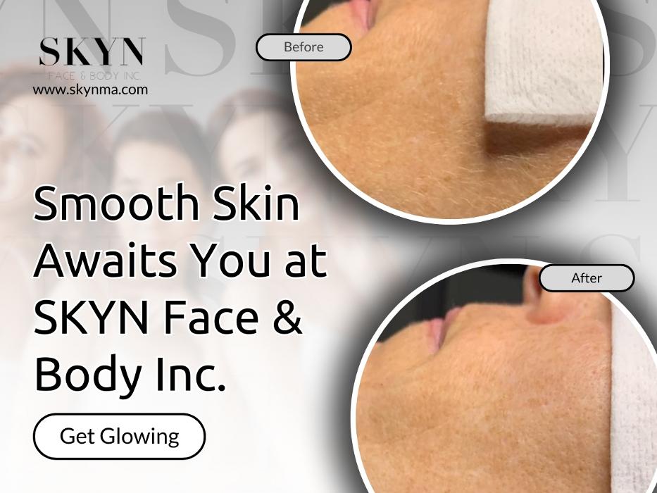 SKYN Face & Body Inc. - Northborough, MA