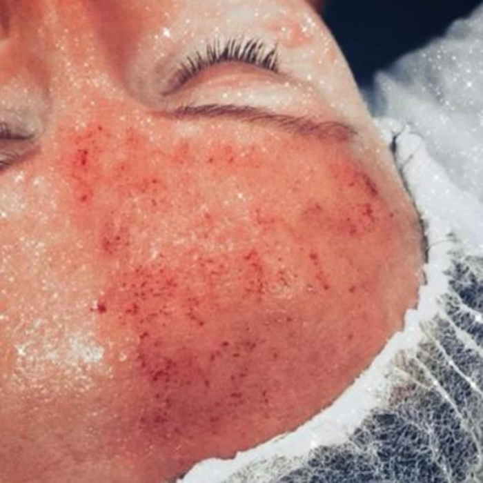 SKYN Face & Body Inc. - Northborough, MA