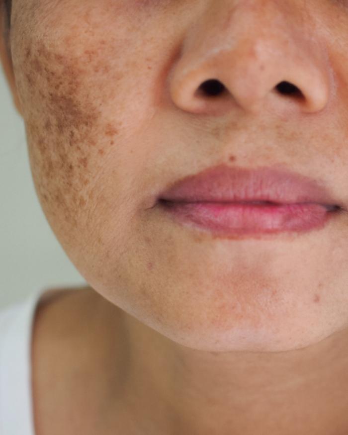 Transformation Medical Center - West Columbia, SC