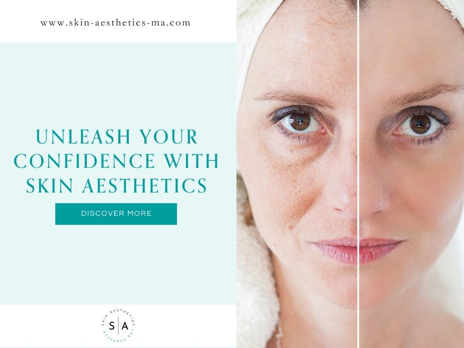 Skin Aesthetics - Buzzards Bay, MA