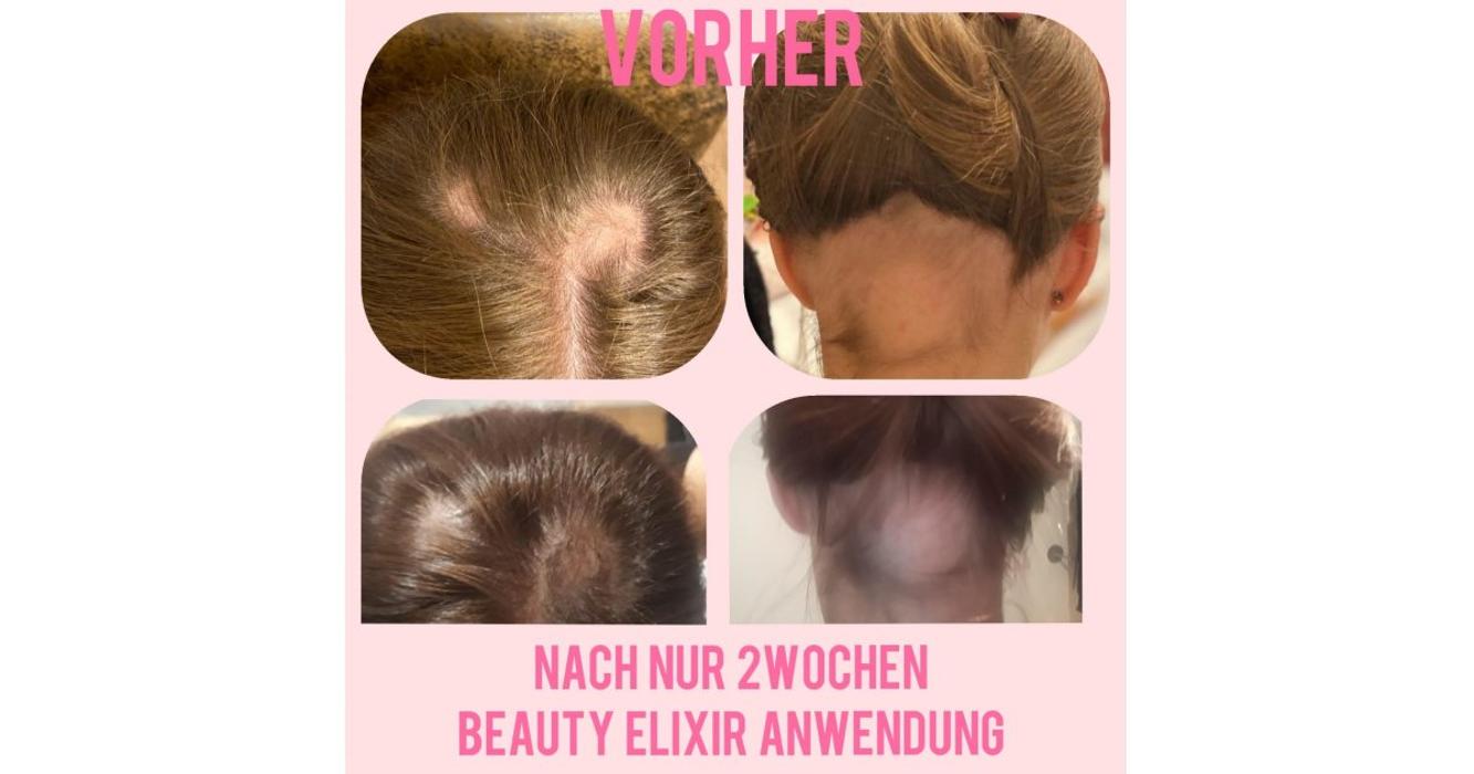 LR Hautnah, Auf der Schomm in Nettetal