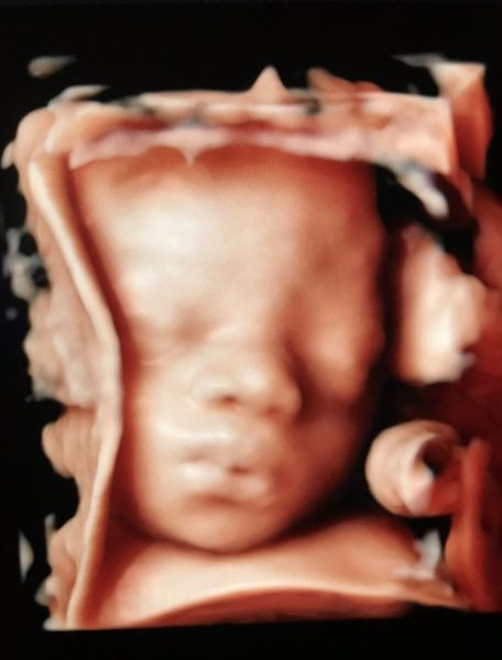 Cam Erwan sage femme