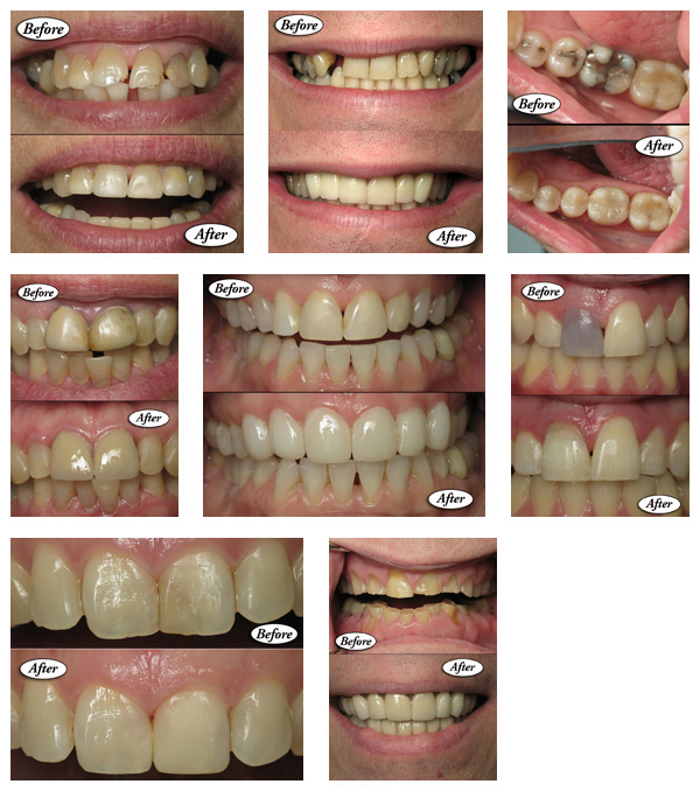 Waltzer Berry Dental Associates of Cherry Hill Image