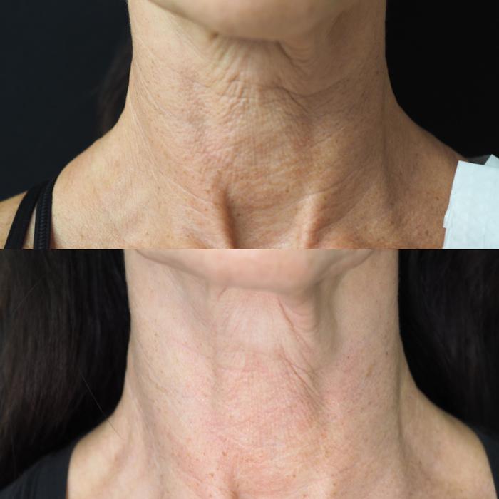 SOM Aesthetics - Encinitas, CA