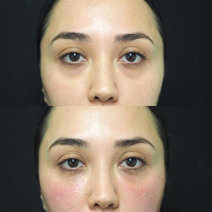 SOM Aesthetics - Encinitas, CA