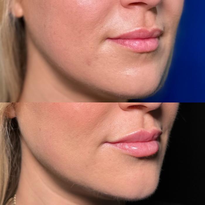 SOM Aesthetics - Encinitas, CA