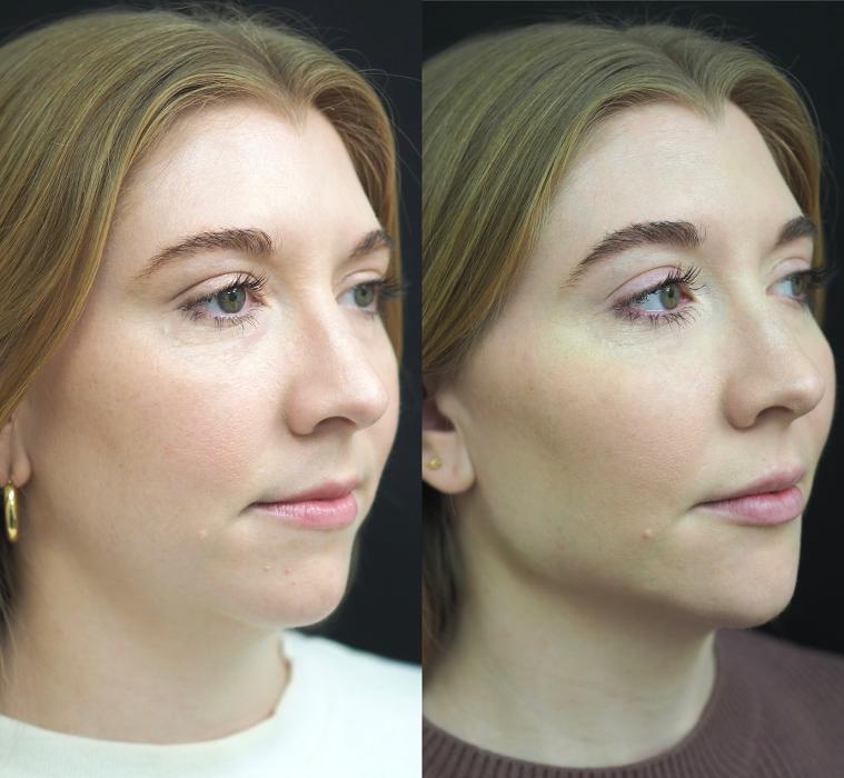 SOM Aesthetics - Encinitas, CA