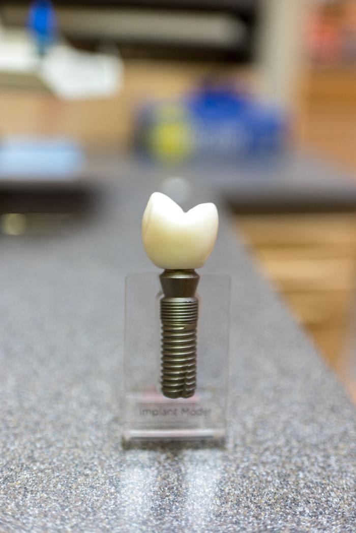 Solon Dental Excellence - Solon, OH