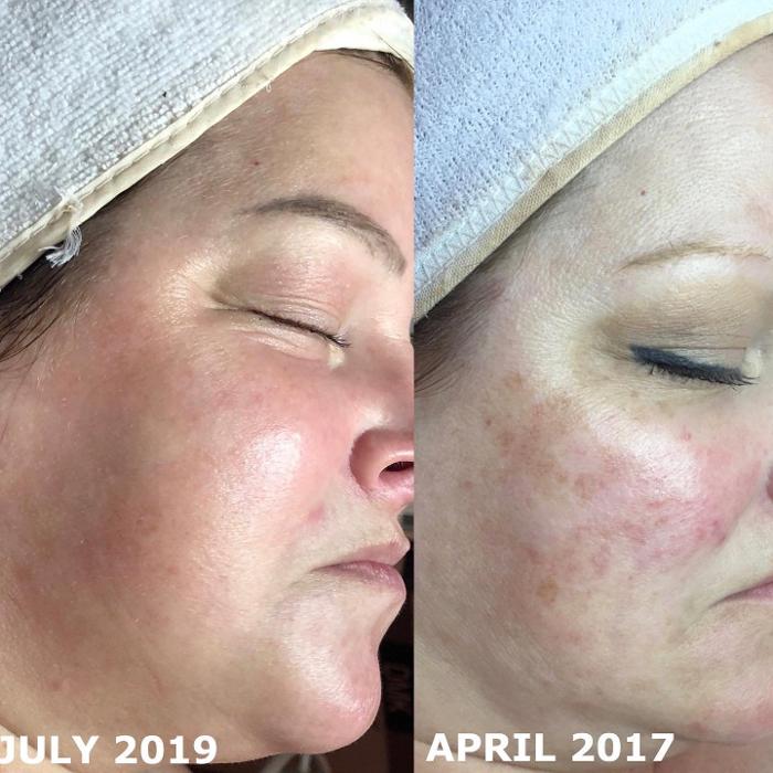 Allyson-Brittany Aesthetics - York, PA