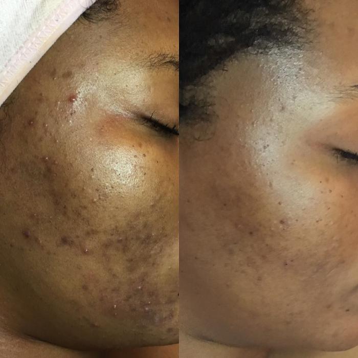 Allyson-Brittany Aesthetics - York, PA