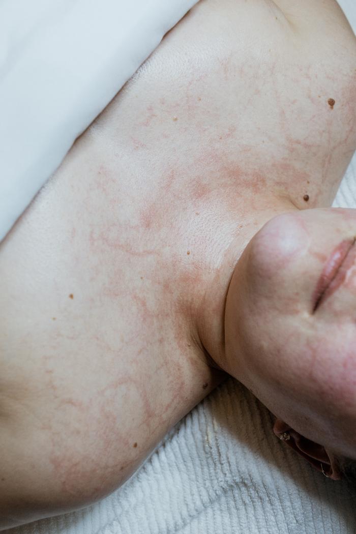 Allyson-Brittany Aesthetics - York, PA