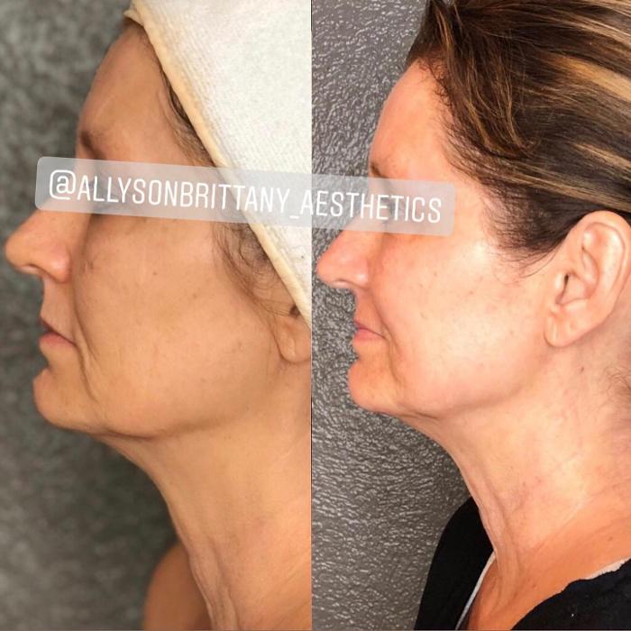 Allyson-Brittany Aesthetics - York, PA
