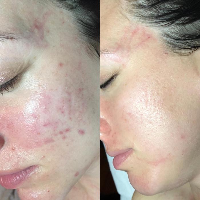 Allyson-Brittany Aesthetics - York, PA