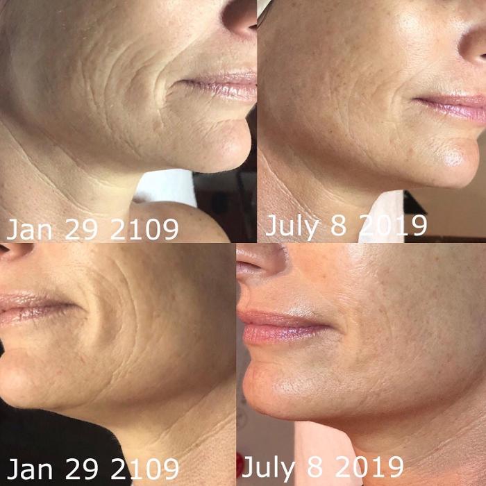 Allyson-Brittany Aesthetics - York, PA