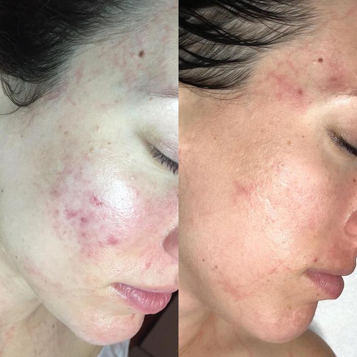 Allyson-Brittany Aesthetics - York, PA