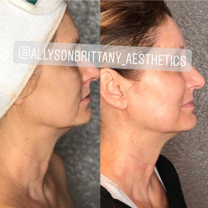 Allyson-Brittany Aesthetics - York, PA