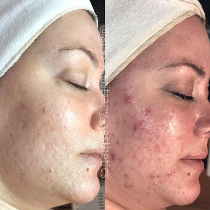 Allyson-Brittany Aesthetics - York, PA