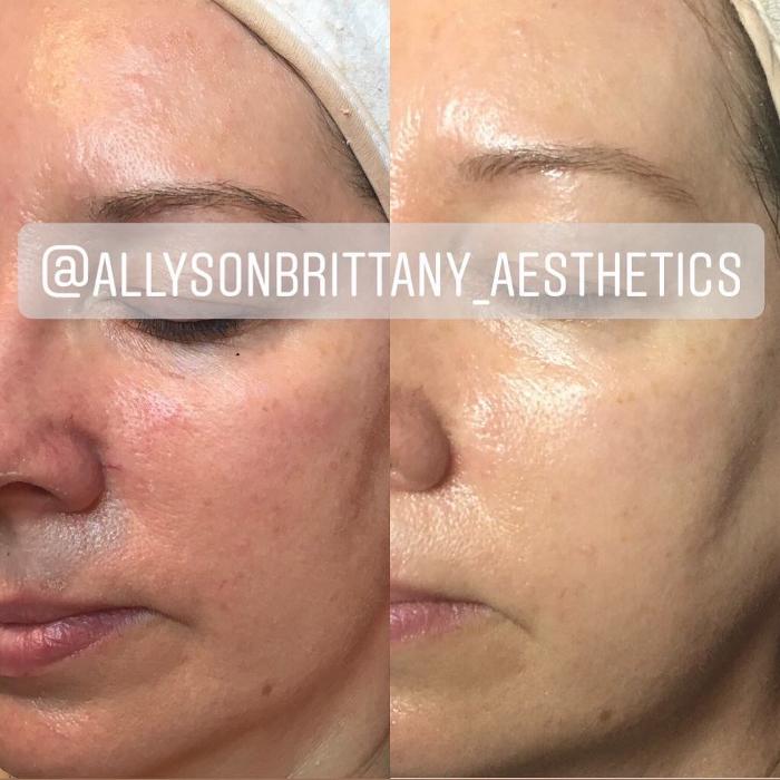 Allyson-Brittany Aesthetics - York, PA