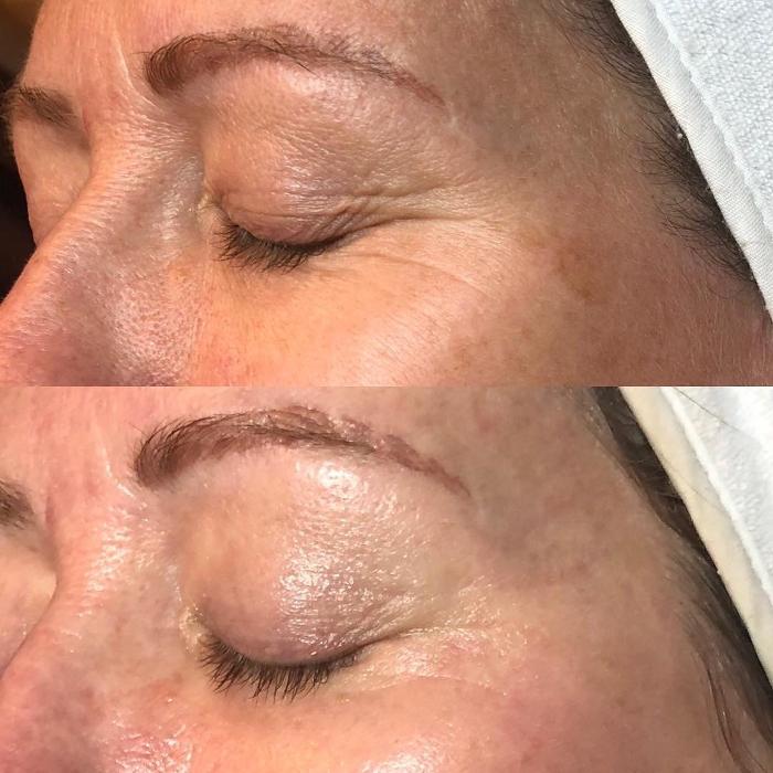 Allyson-Brittany Aesthetics - York, PA