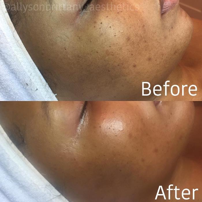 Allyson-Brittany Aesthetics - York, PA