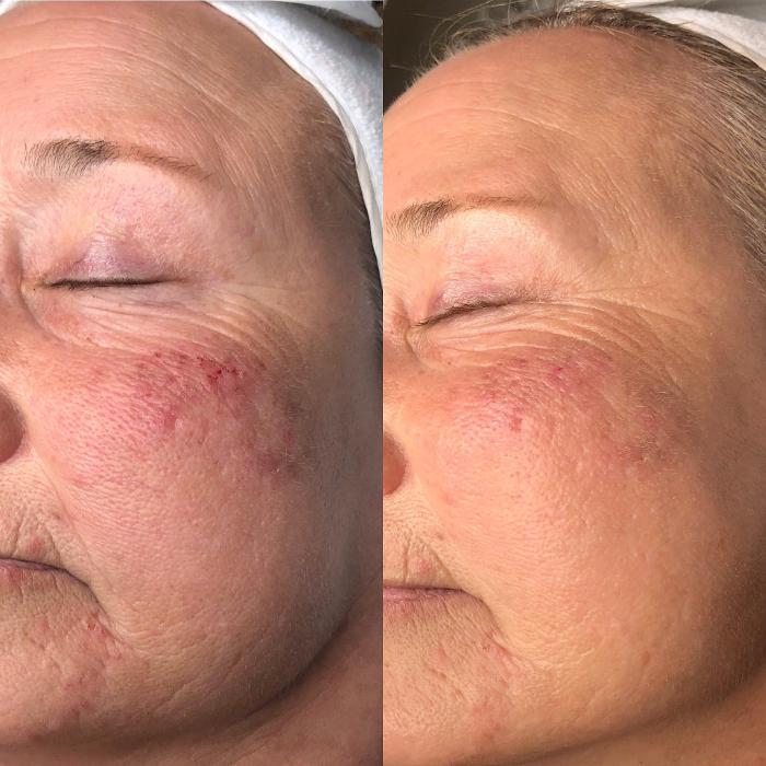 Allyson-Brittany Aesthetics - York, PA