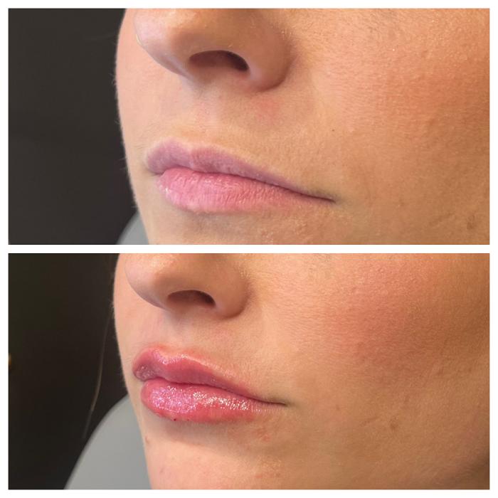 Truly Lifted MedSpa - Georgetown, TX