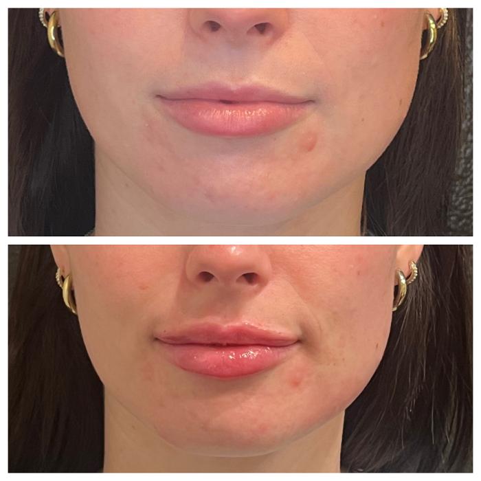 Truly Lifted MedSpa - Georgetown, TX