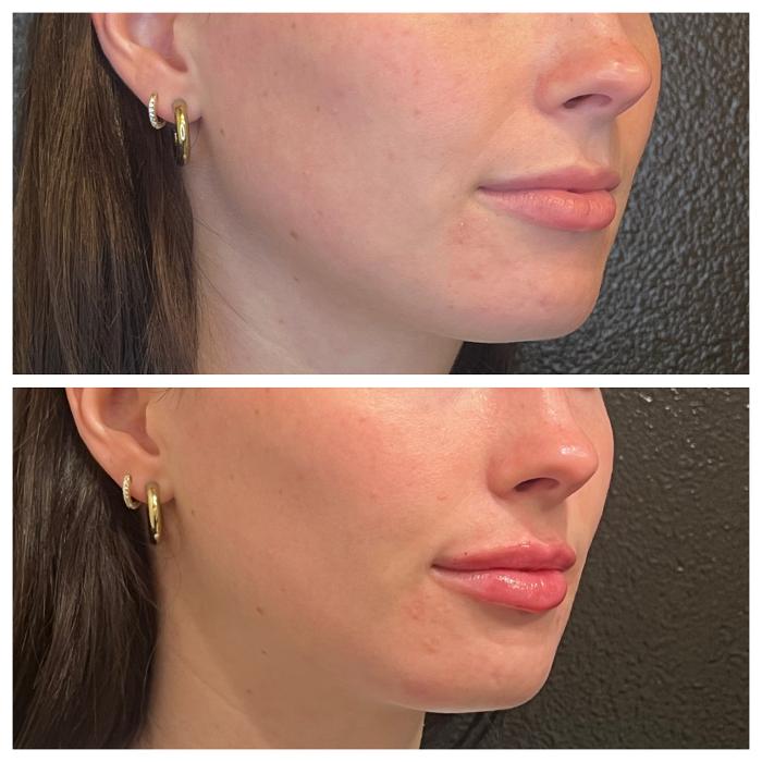 Truly Lifted MedSpa - Georgetown, TX