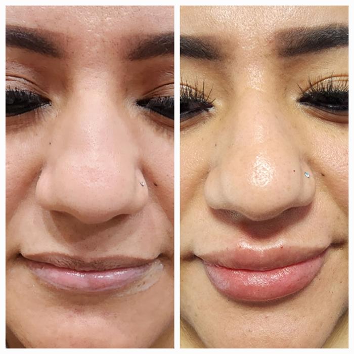 WIN, MD Health and Aesthetics - New Caney, TX