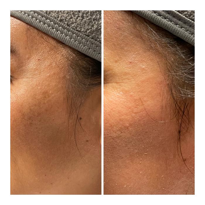 Radiance Esthetics & Med Spa - Jackson, TN