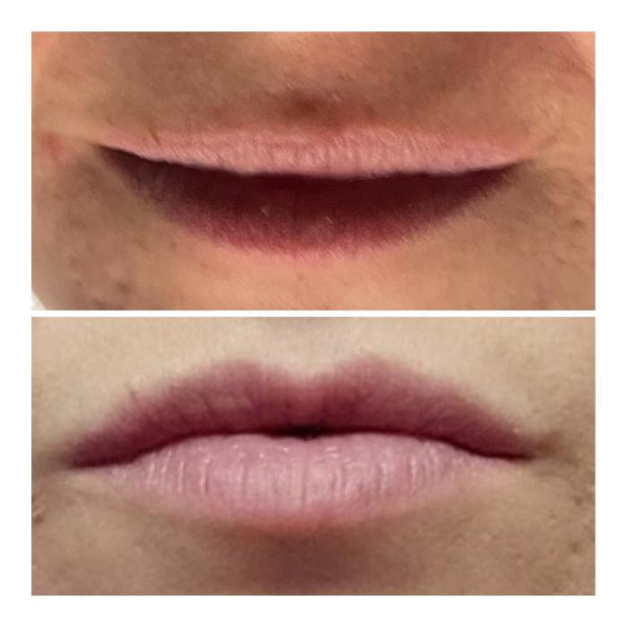 Radiance Esthetics & Med Spa - Jackson, TN