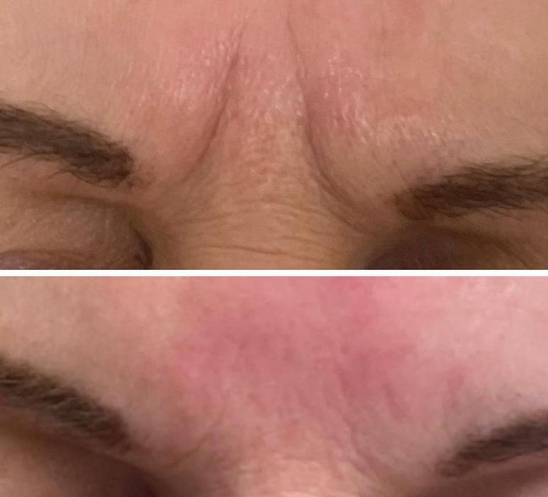 Radiance Esthetics & Med Spa - Jackson, TN