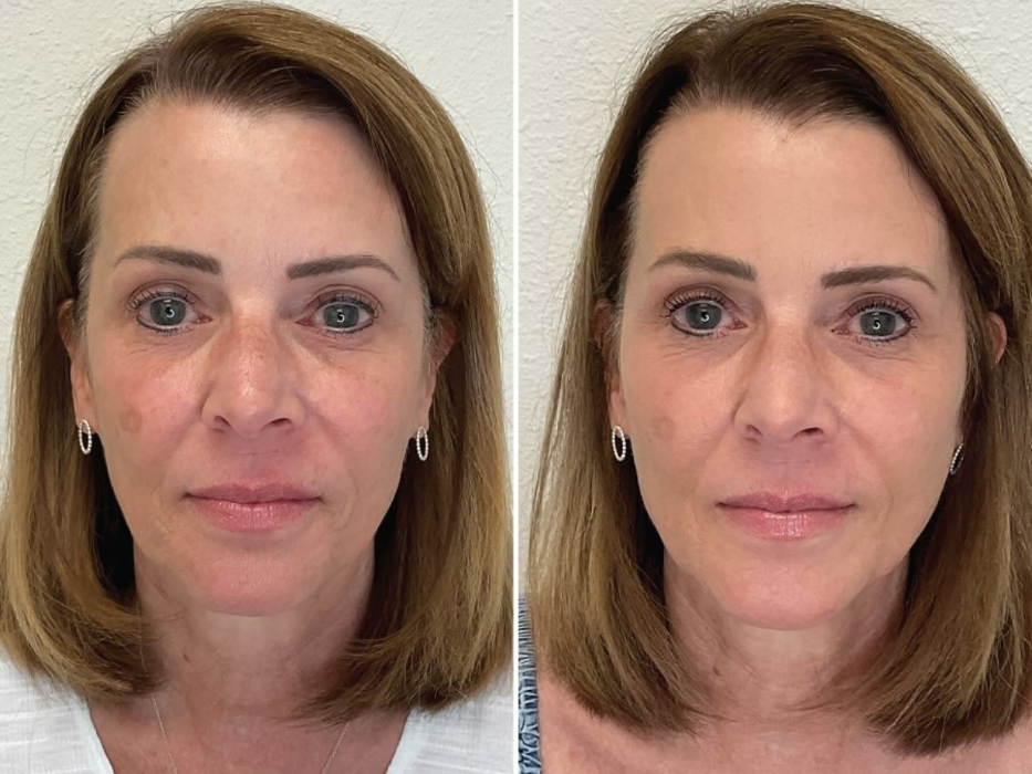 REAL | Aesthetic Medicine + Skincare Science - Santa Rosa, CA