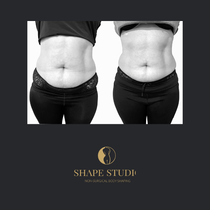 Foto de Shape Studio Tauranga