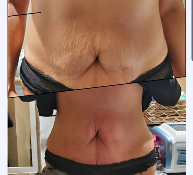 SlimNGlow Studio - Hoboken, NJ