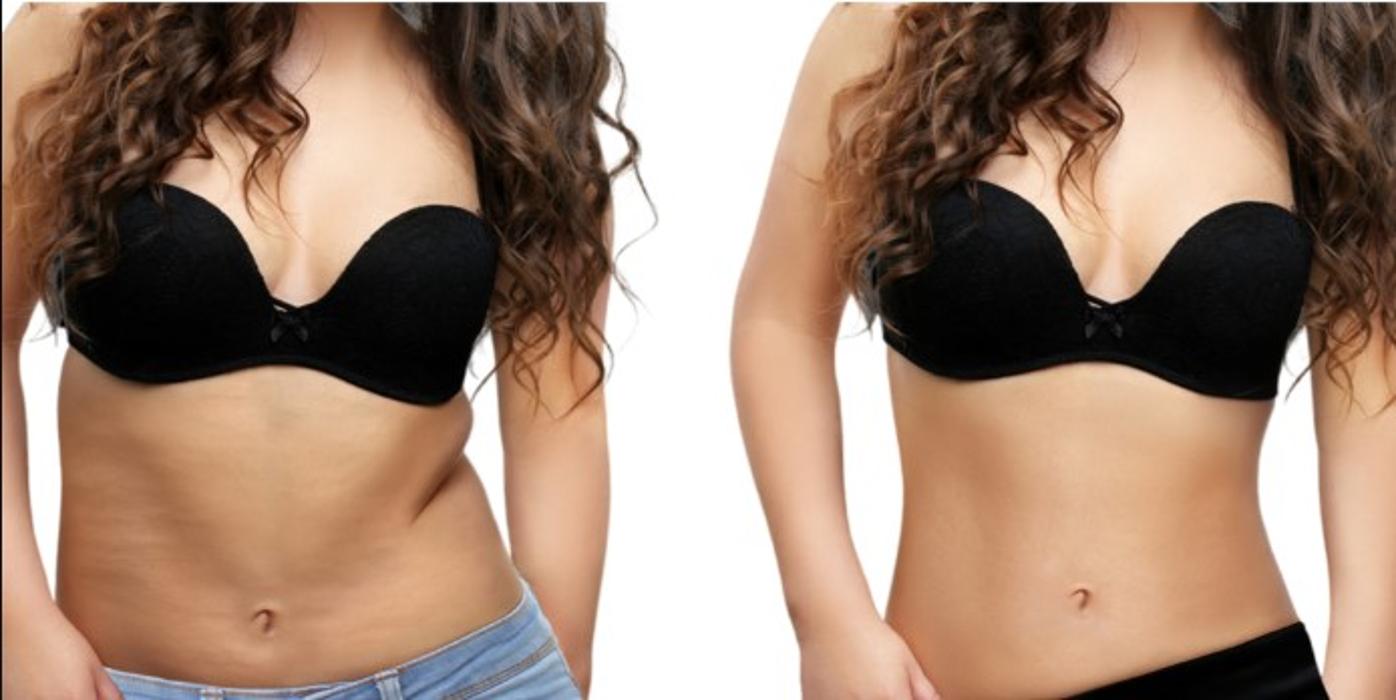 SlimNGlow Studio - Hoboken, NJ