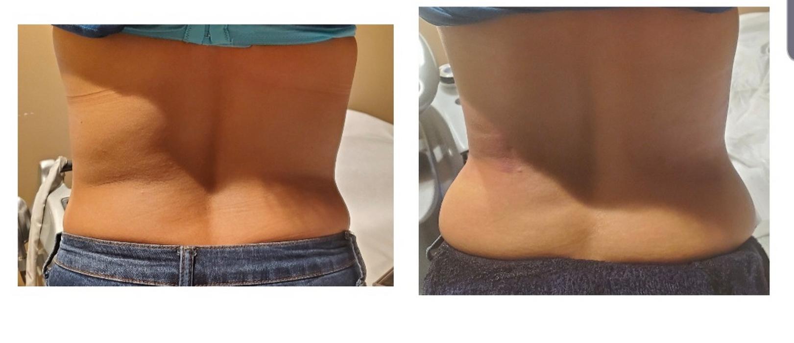 SlimNGlow Studio - Hoboken, NJ