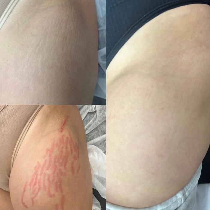 Buffalo Beauty Brows LLC - Buffalo, NY